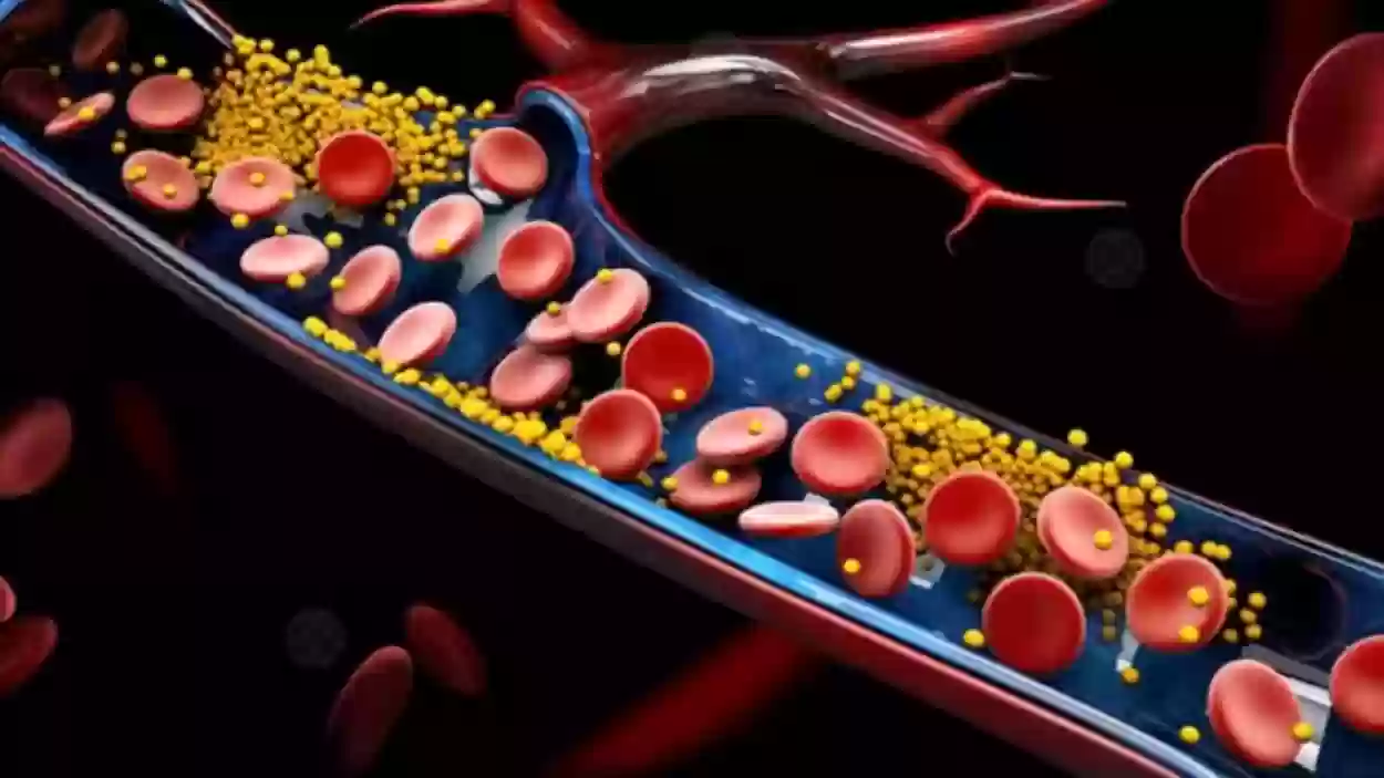 4 علامات على ارتفاع الكوليسترول