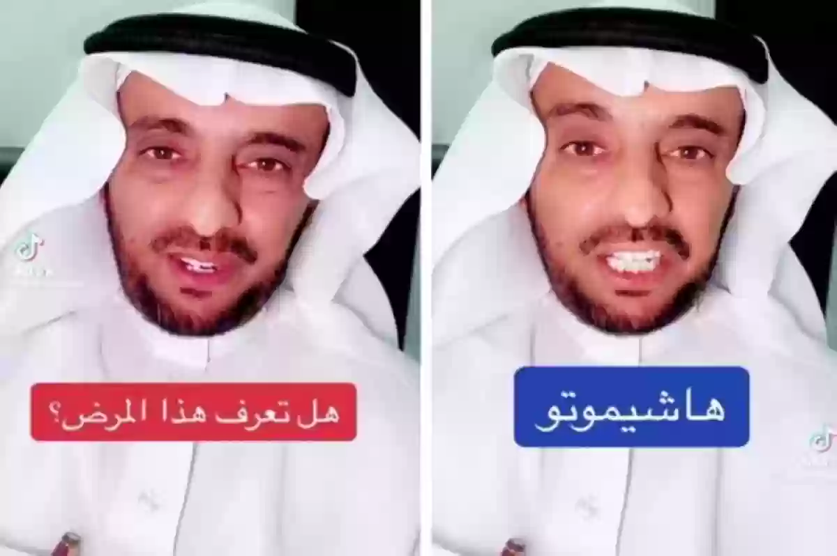 مرض مناعي يفتك بالنساء